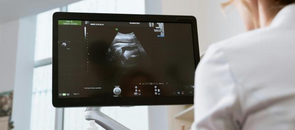 zdjęcie lekarka patrzy na egran usg